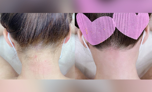 올댓뷰티아카데미 슈가링 페이스 왁싱 받아봤니?